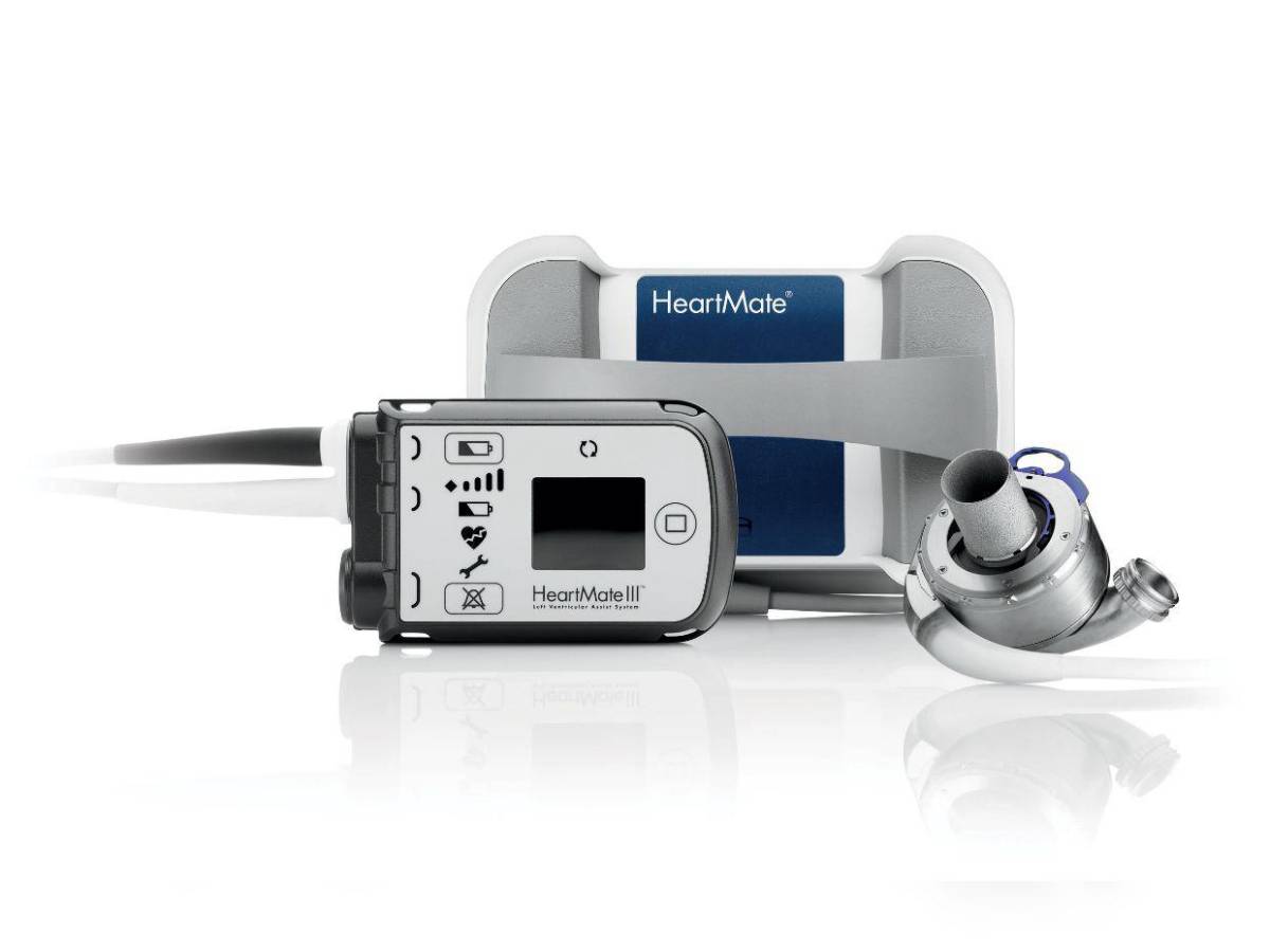 ¿Qué es el corazón artificial de L10.5 millones que necesita diputado de Libre para vivir?