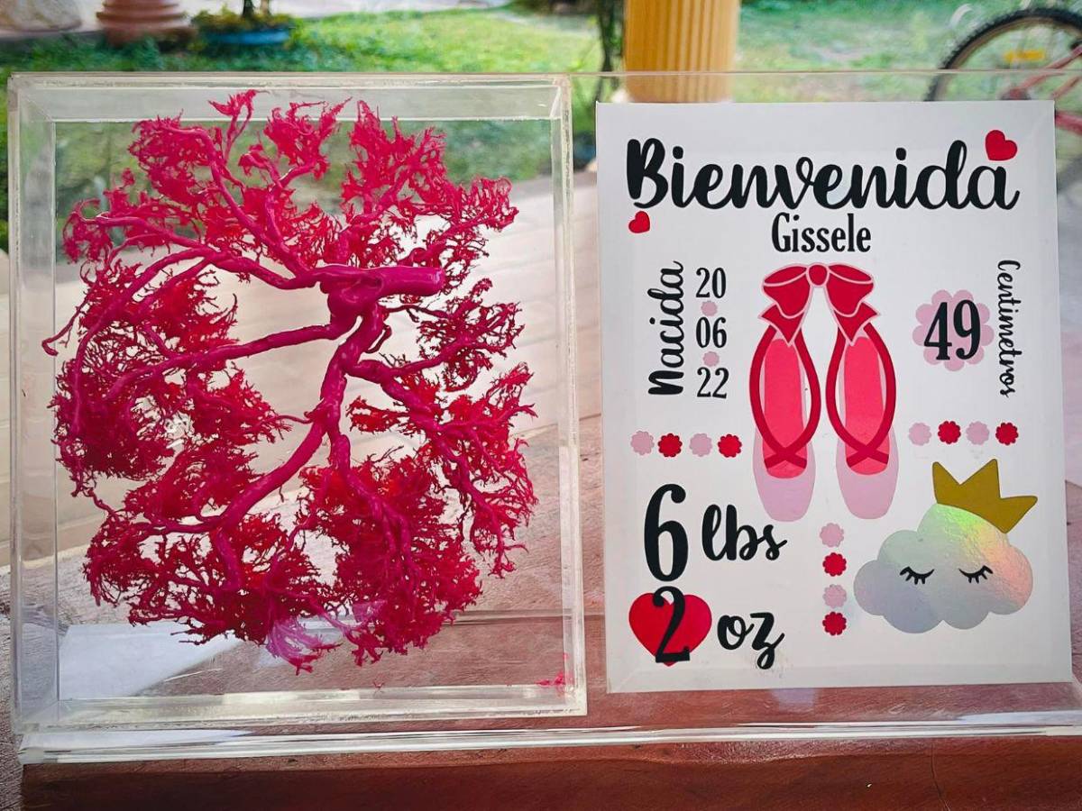 Hondureño transforma placentas en arte y huesos en esculturas sorprendentes