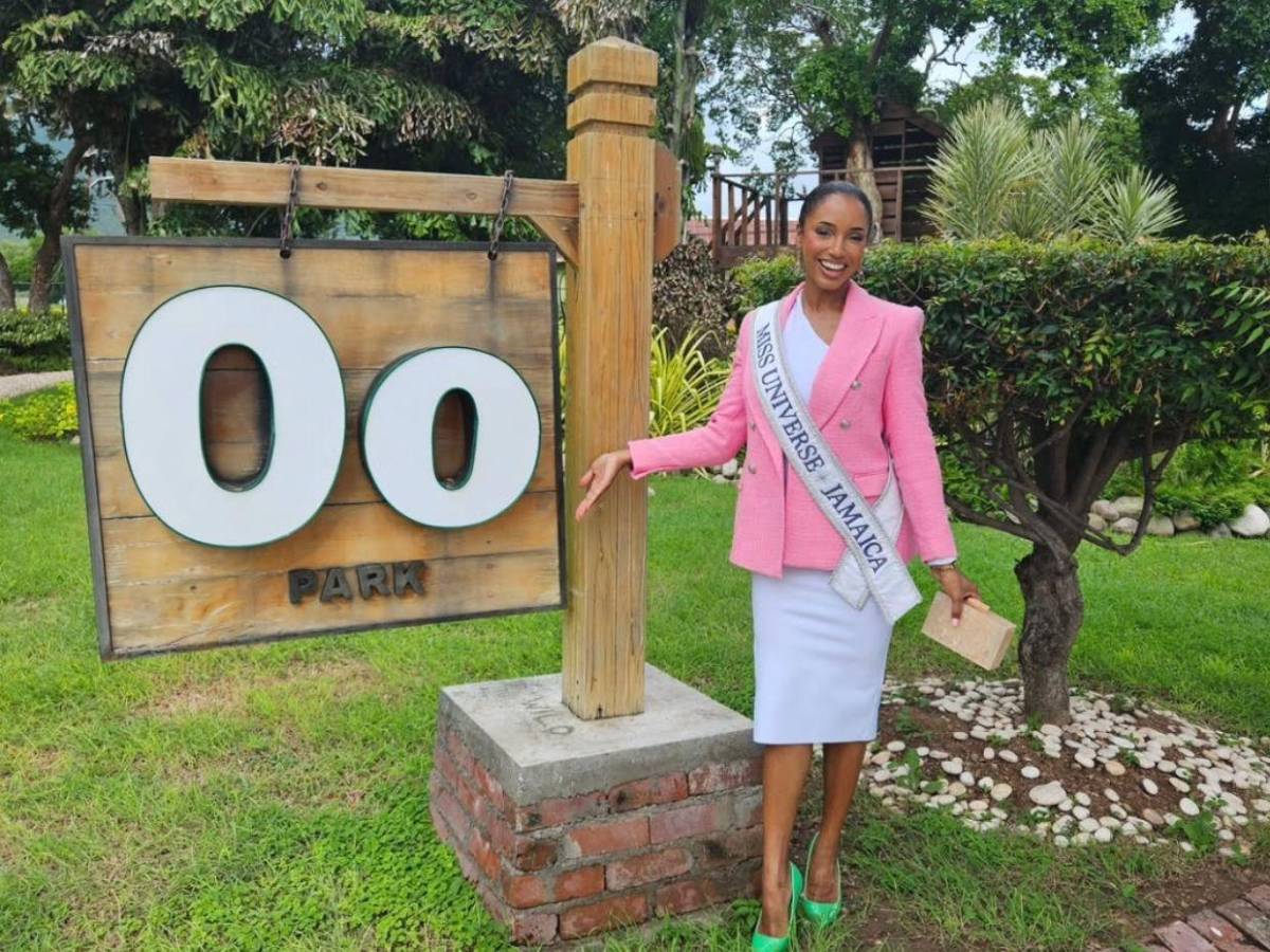 Fractura y hemorragia intracraneal: el diagnóstico de Miss Jamaica tras accidente