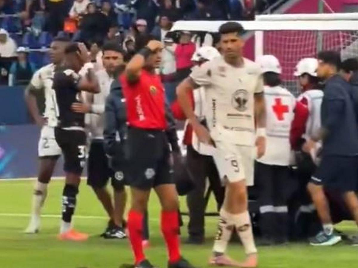 Así fue la espeluznante lesión de tobillo que sufrió Jean Pierre Arroyo