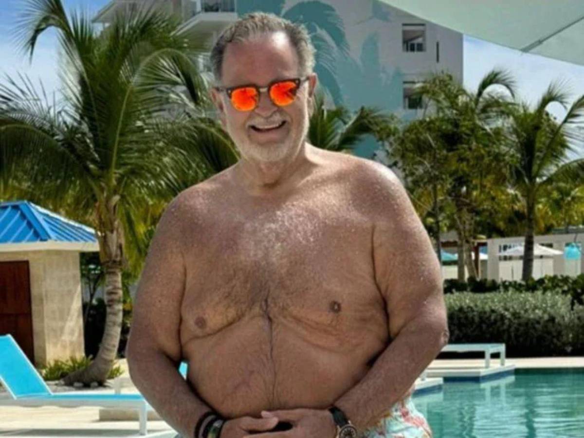 Raúl de Molina, de El gordo y la flaca, sufre complicaciones tras su cirugía estética