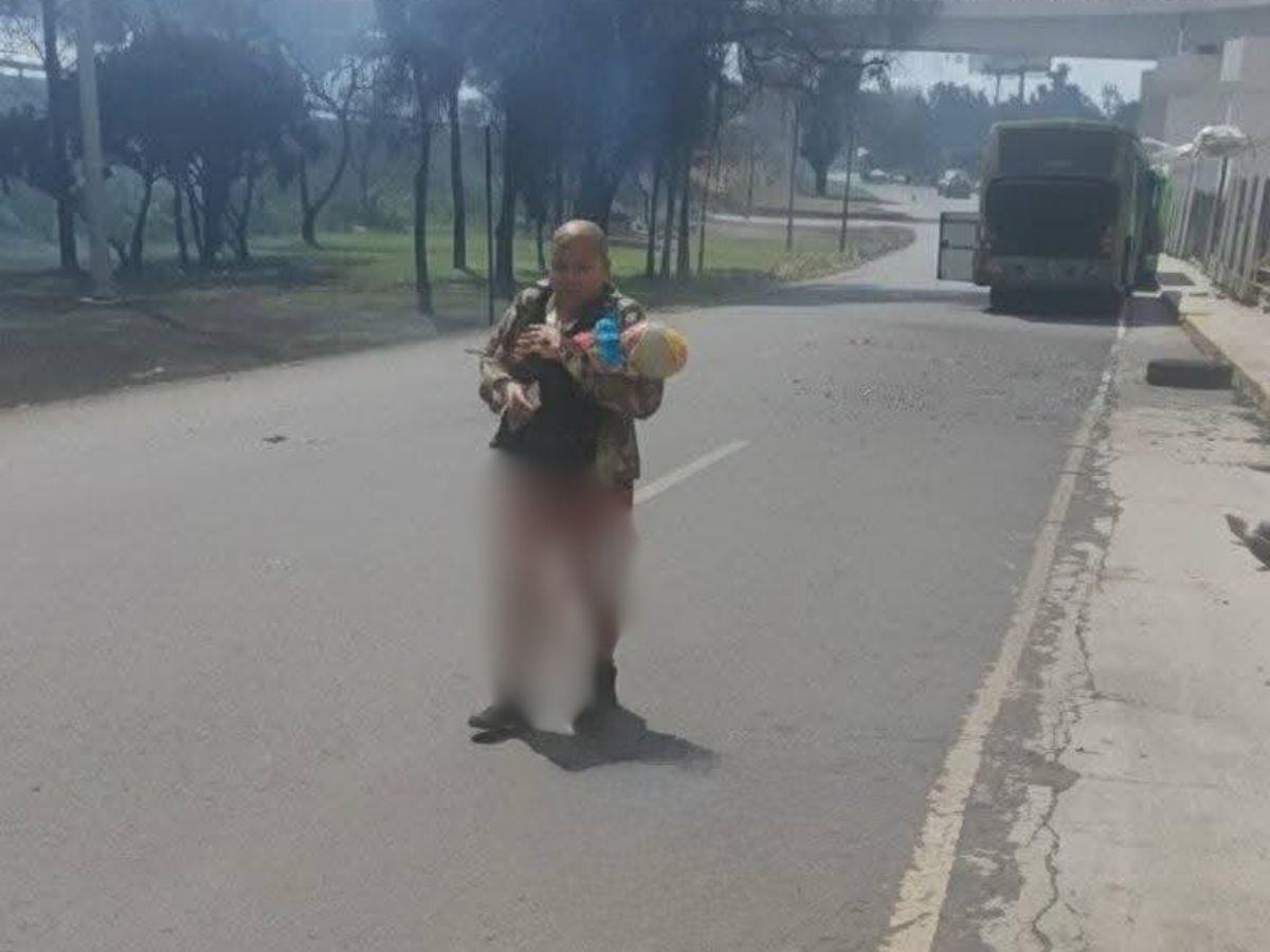 Abuela se quemó el 90% del cuerpo al salvar a su nieta en explosión en CDMX