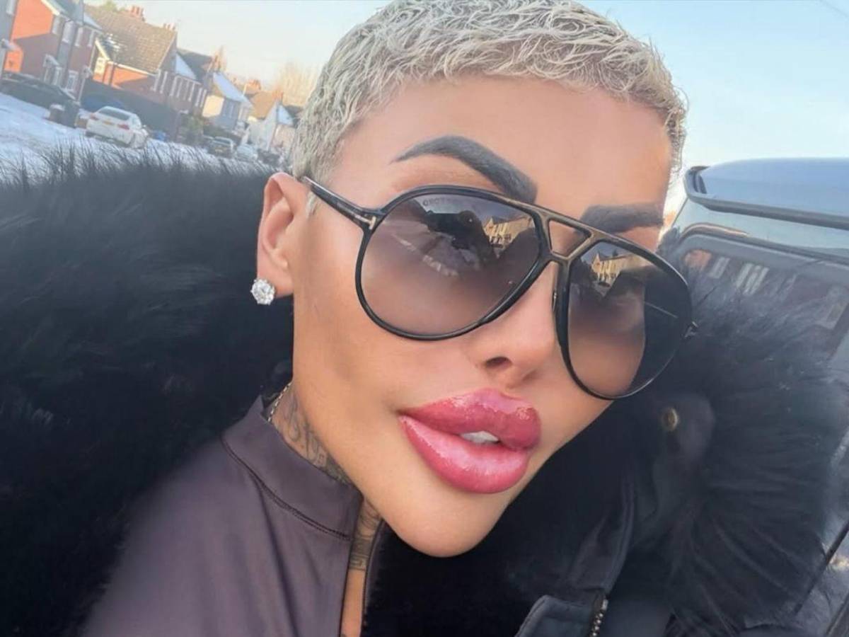 Muere el rey de los labios tras presuntas complicaciones por cirugía estética