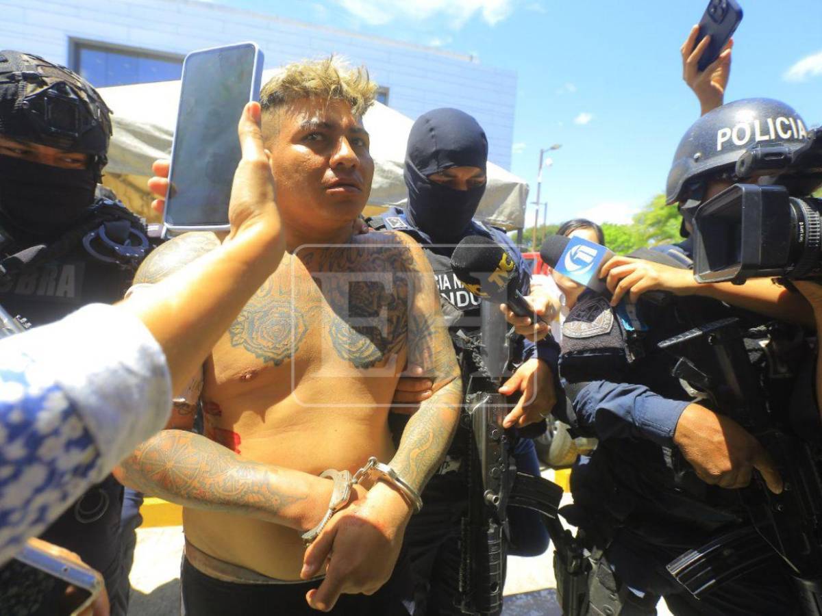 Supuesto líder de “La Kleivona” llega herido a la DPI y niega ser delincuente