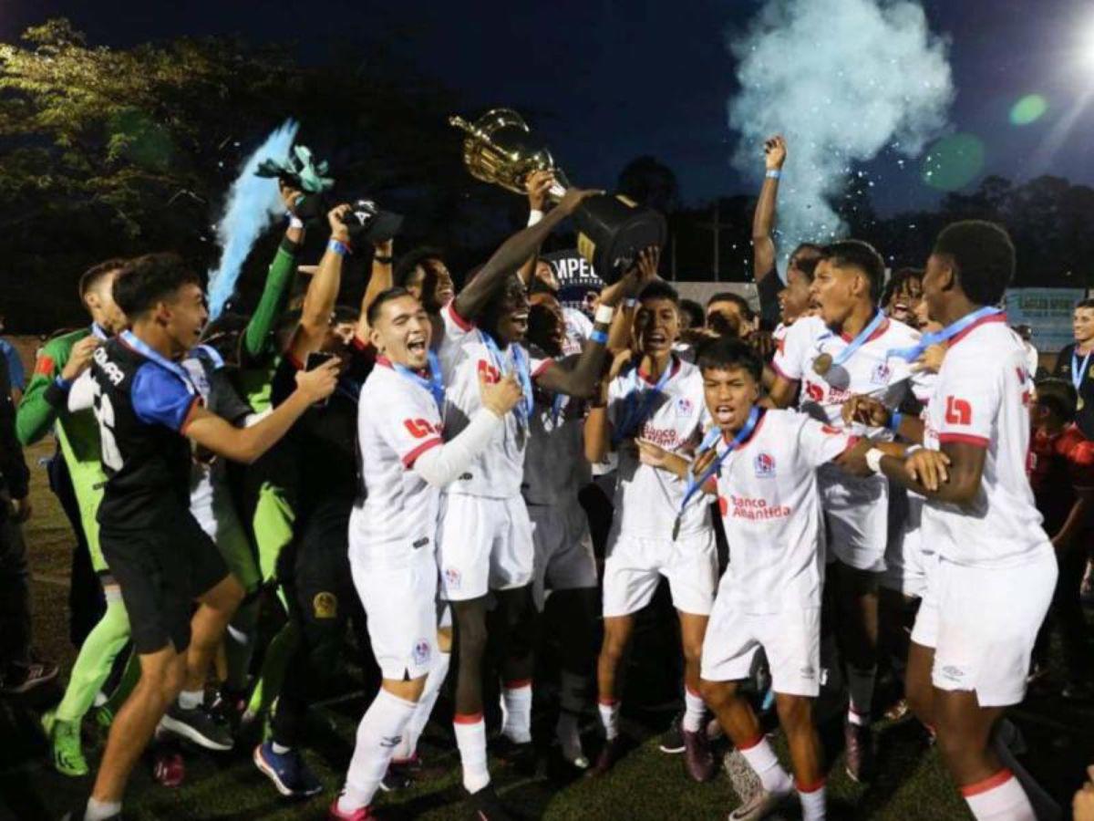 Torneo de Reservas inicia este miércoles: Así se jugará la primera jornada