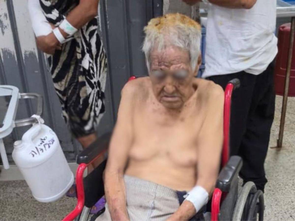 Adultos mayores sufren quemaduras tras incendio que arrasó con seis viviendas en barrio San Martín