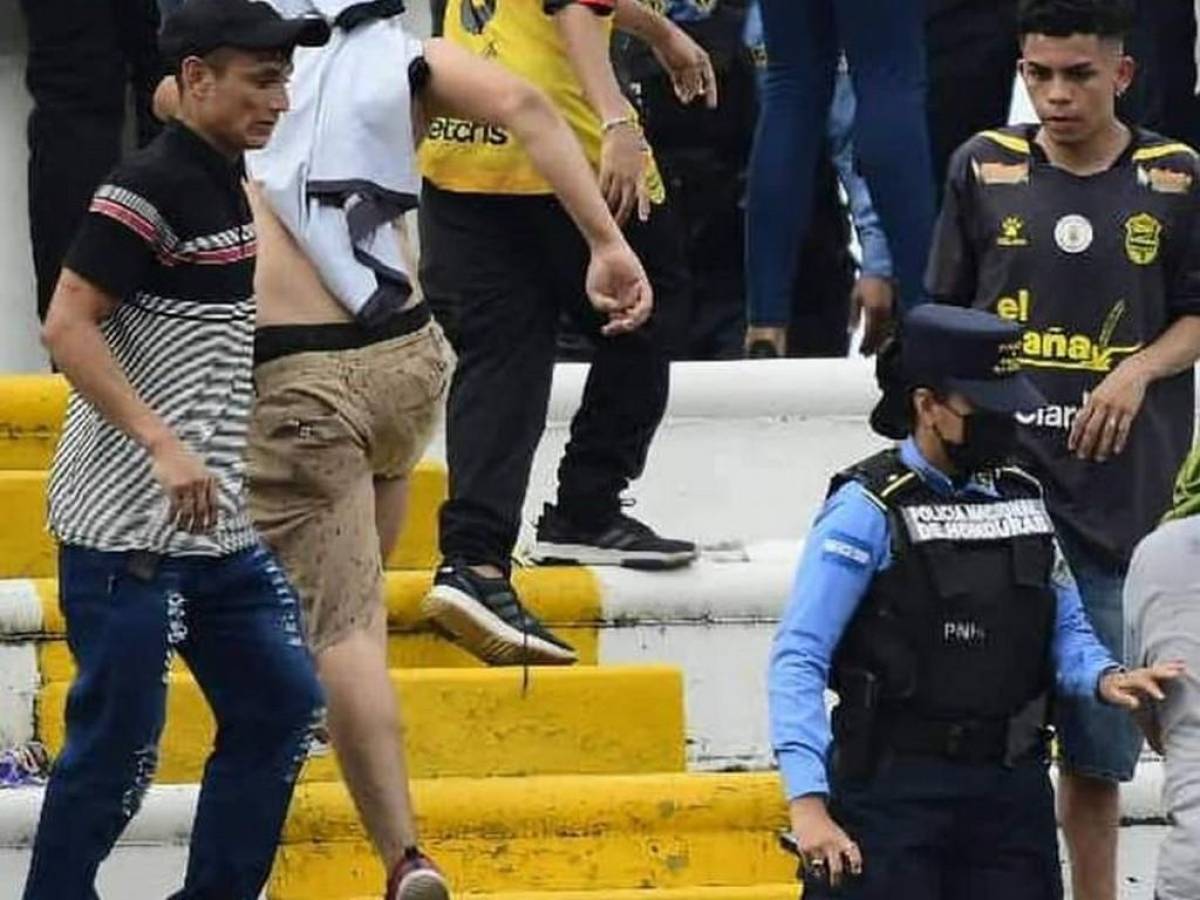 Continúa búsqueda de sujeto que atentó contra mujer policía en estadio Olímpico