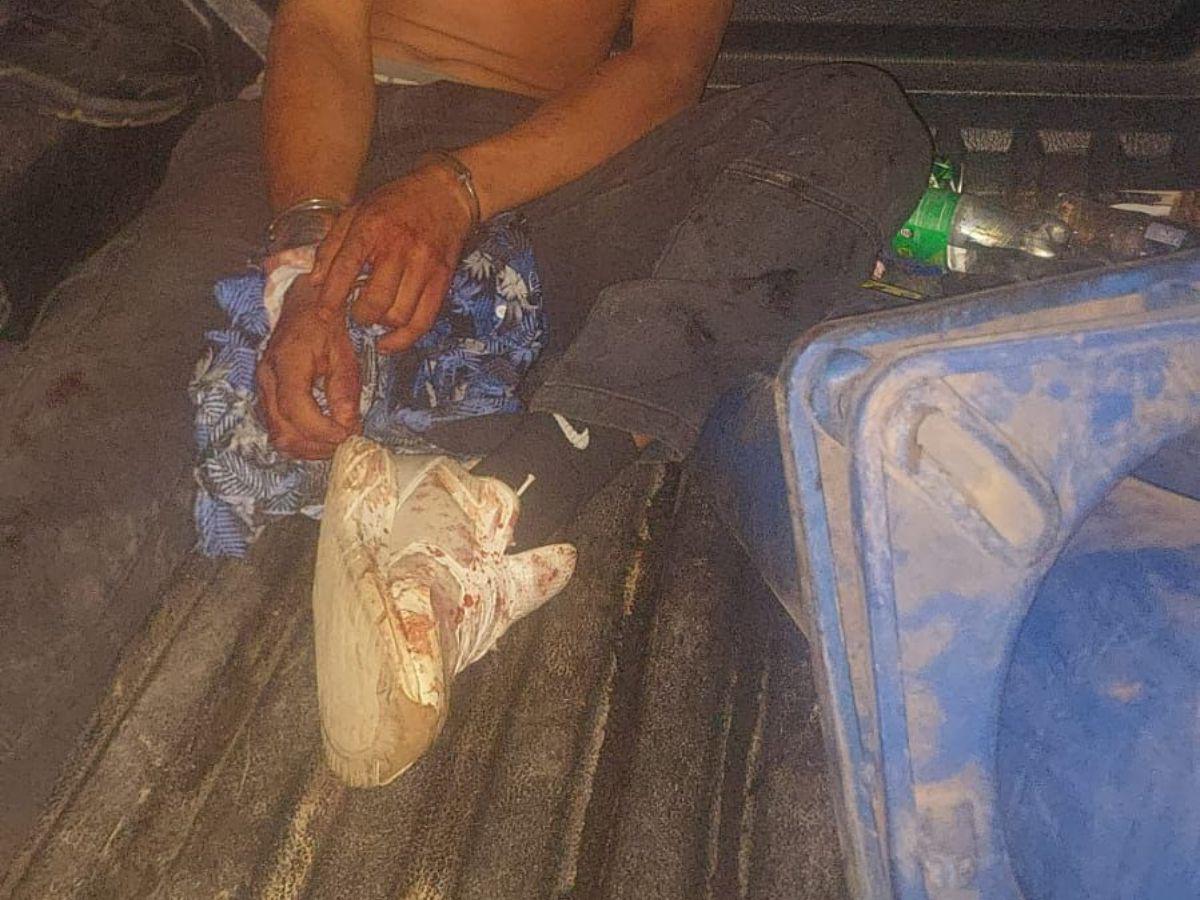 Lo golpeó varias veces en la cabeza: así mataron a pedradas a un hombre en Olancho