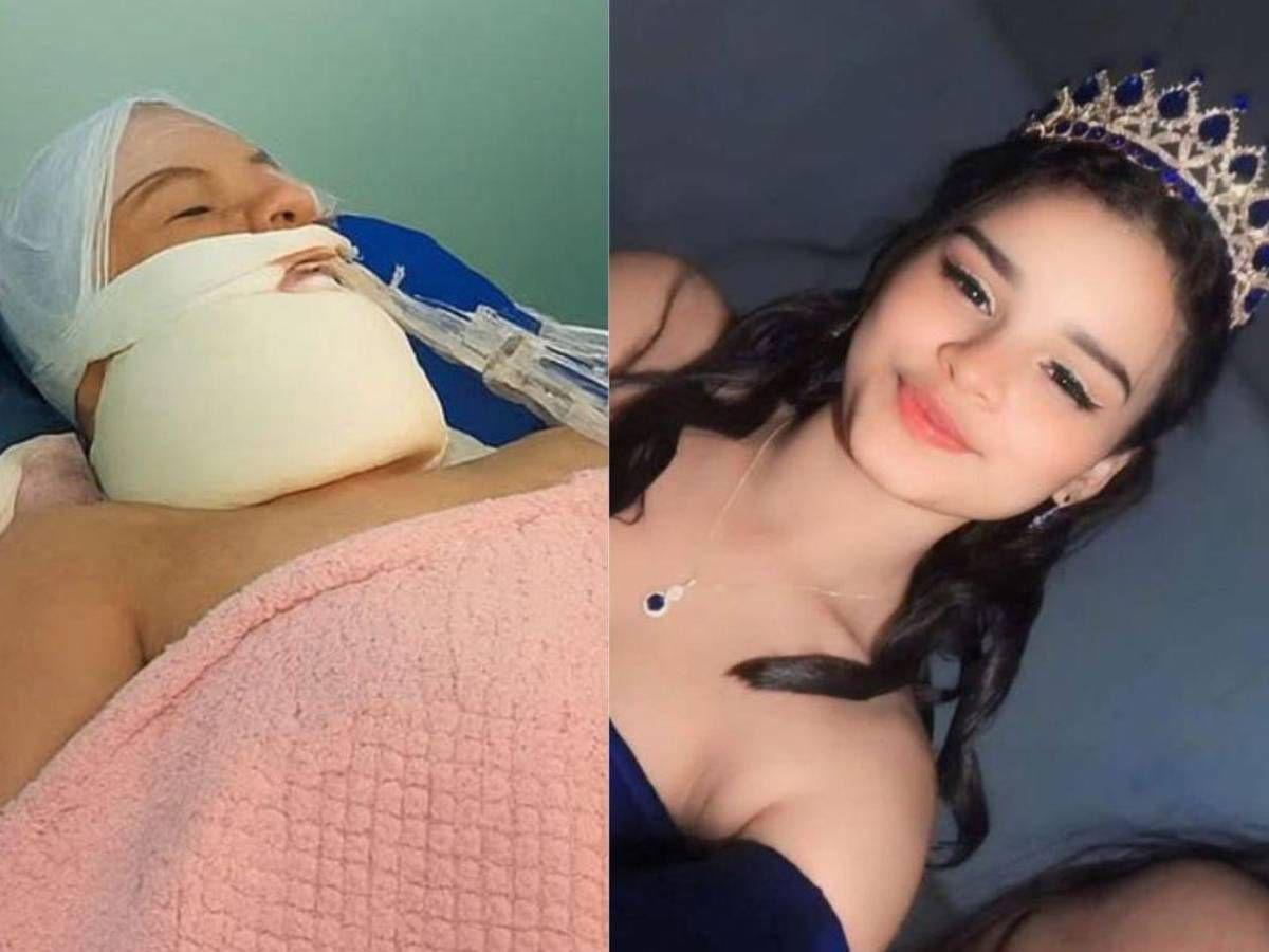 ​​​​Ledis Esmeralda Martínez, la quinceañera que perdió la vida tras un accidente en Olancho