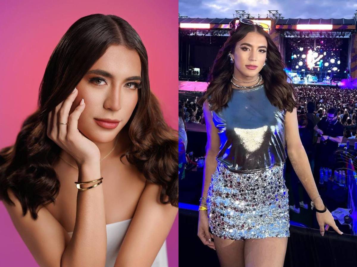 ¿La Bicha Catracha se sometió a cirugía de transformación?: Me opero el cuerpo del deseo