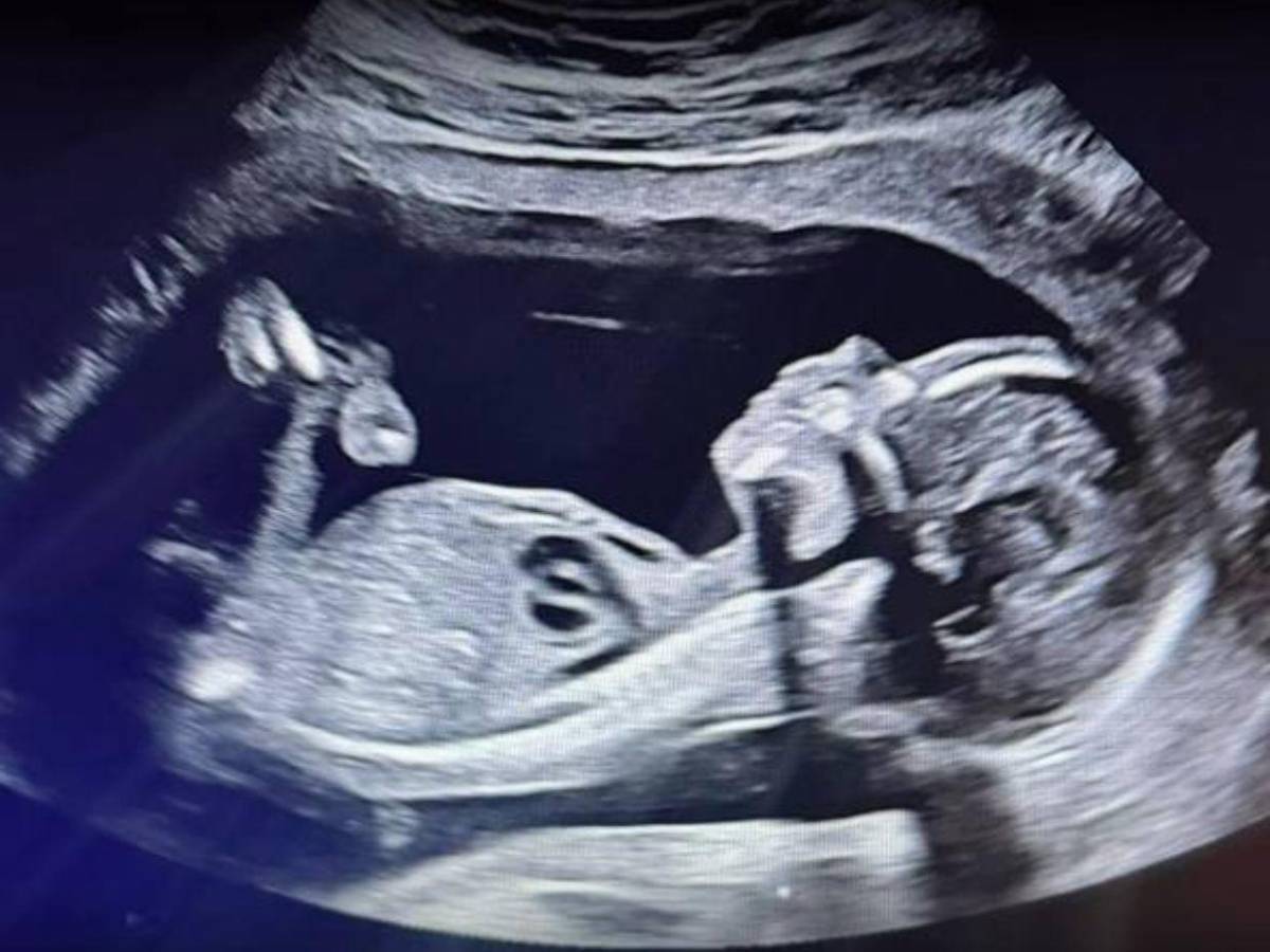 “Después de 12 años”: Ana Alvarado y Jorge Cordero anuncian que esperan su primer bebé