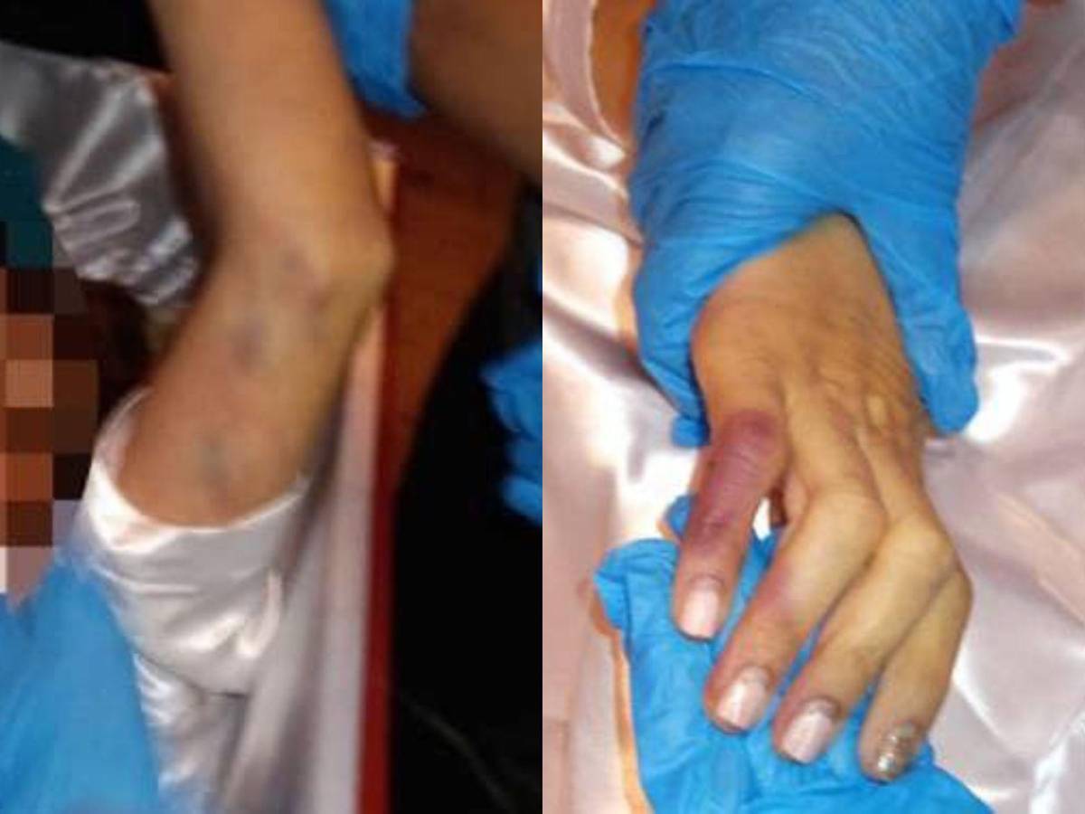 La mató e intentó encubrirlo como suicidio: Johnson, culpable en crimen de la doctora Ferrera