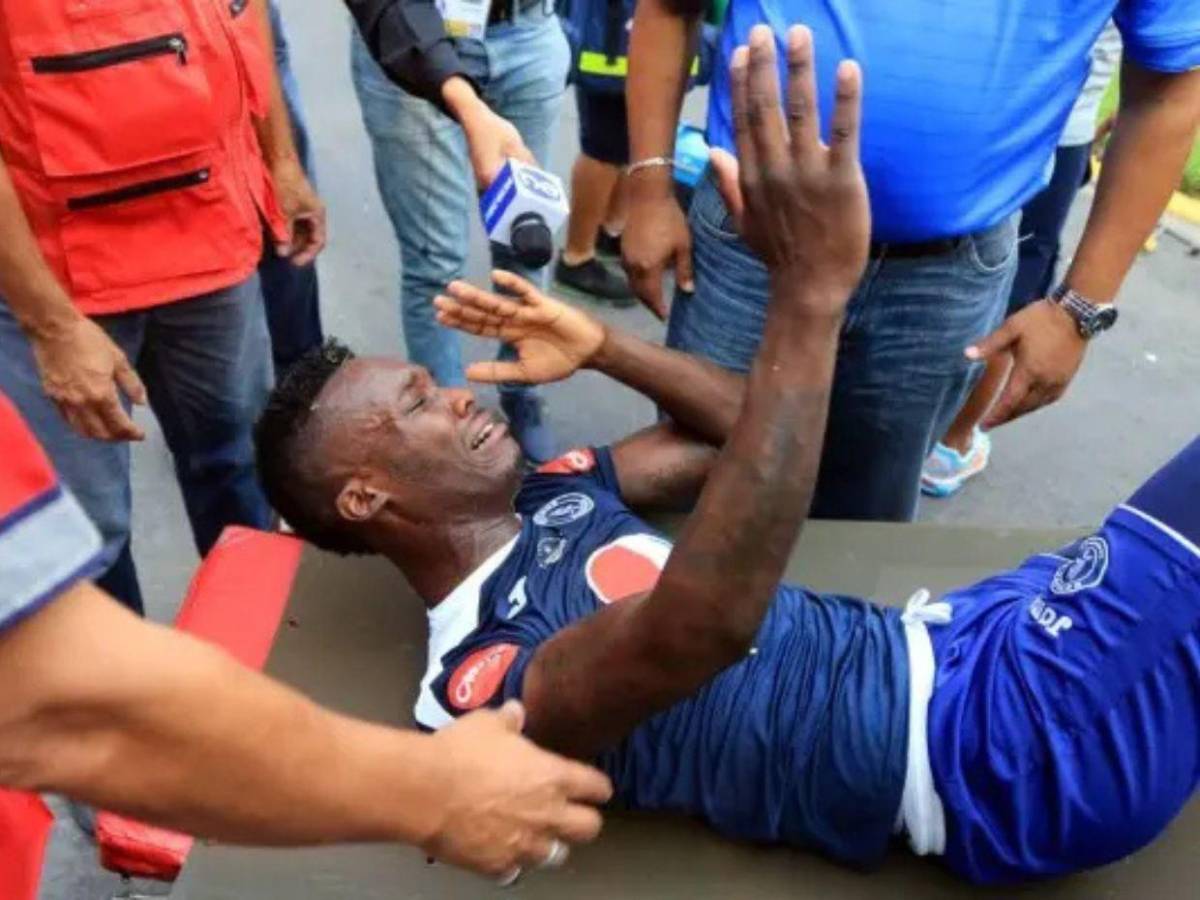 Las lesiones más escalofriantes que han ocurrido en el fútbol hondureño