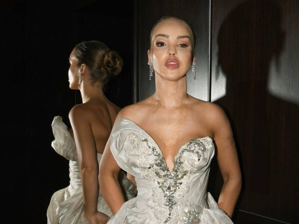 ¿Qué ha sido de Katie Piper, la presentadora a la que le tiraron ácido en la cara?