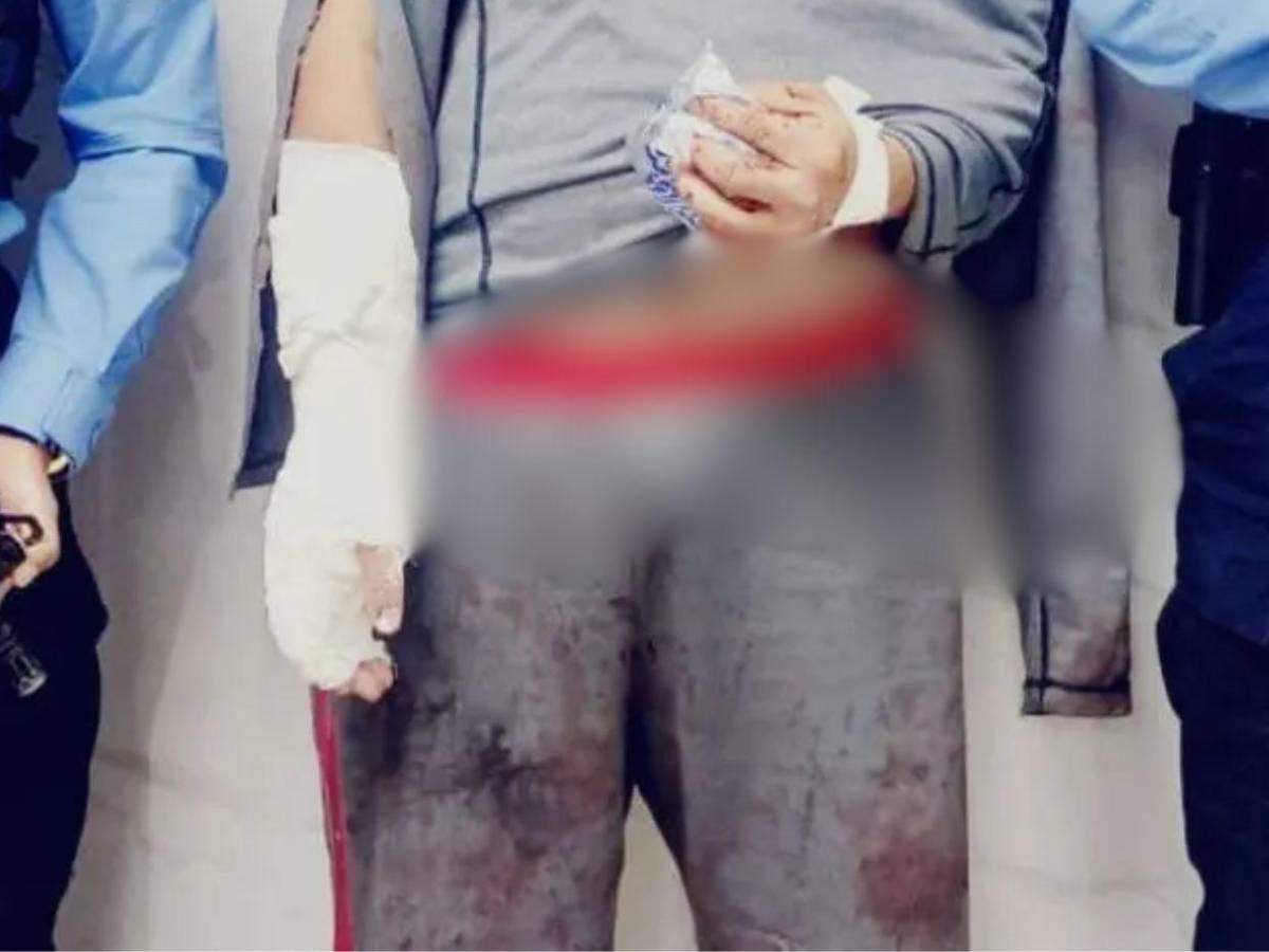 Agredió a un gato y le reclamaron: Ricardo mató a su tía e hirió a su mamá y abuela en Los Pinos