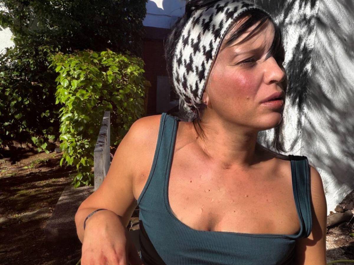 Hija trans de Camilo Sesto ingresa grave a hospital: esto se sabe