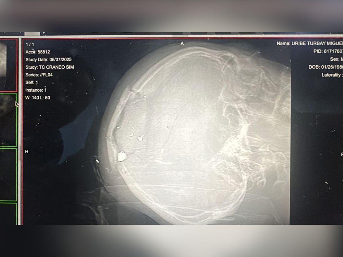 Esto se sabe del atentado contra Miguel Uribe Turbay en Colombia