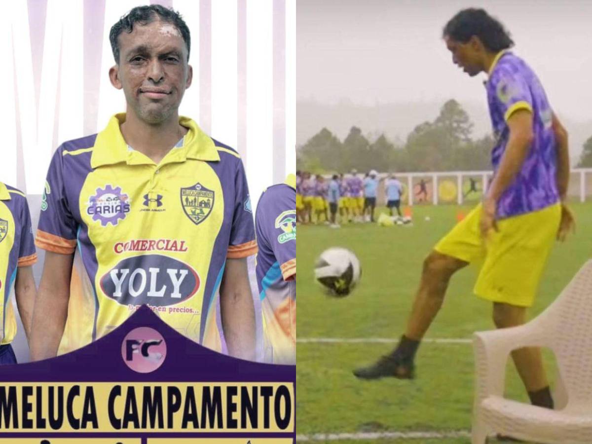 ¿Por qué Pedro Joaquín Amador fue contratado por un club del Ascenso?