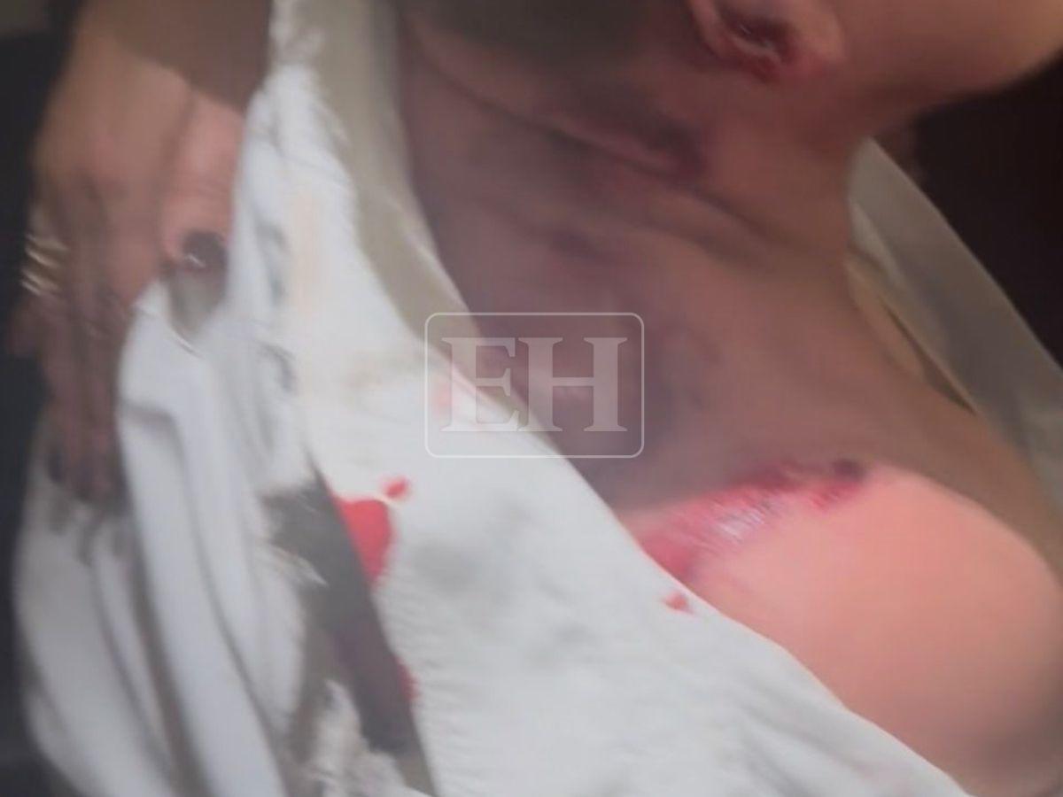 En fotos: Así fue el ataque con explosivo en el CN contra la diputada Gladis López del PN