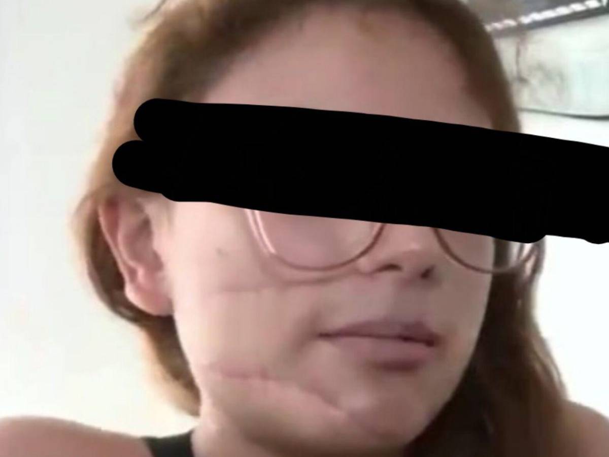 Enfermero ataca a su esposa con más de 25 puñaladas en Ecatepec; la mantenía encerrada