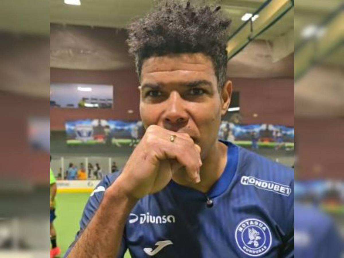 Así es la nueva vida de Shannon Welcome en EE UU: ¿Qué le pasó en su boca?