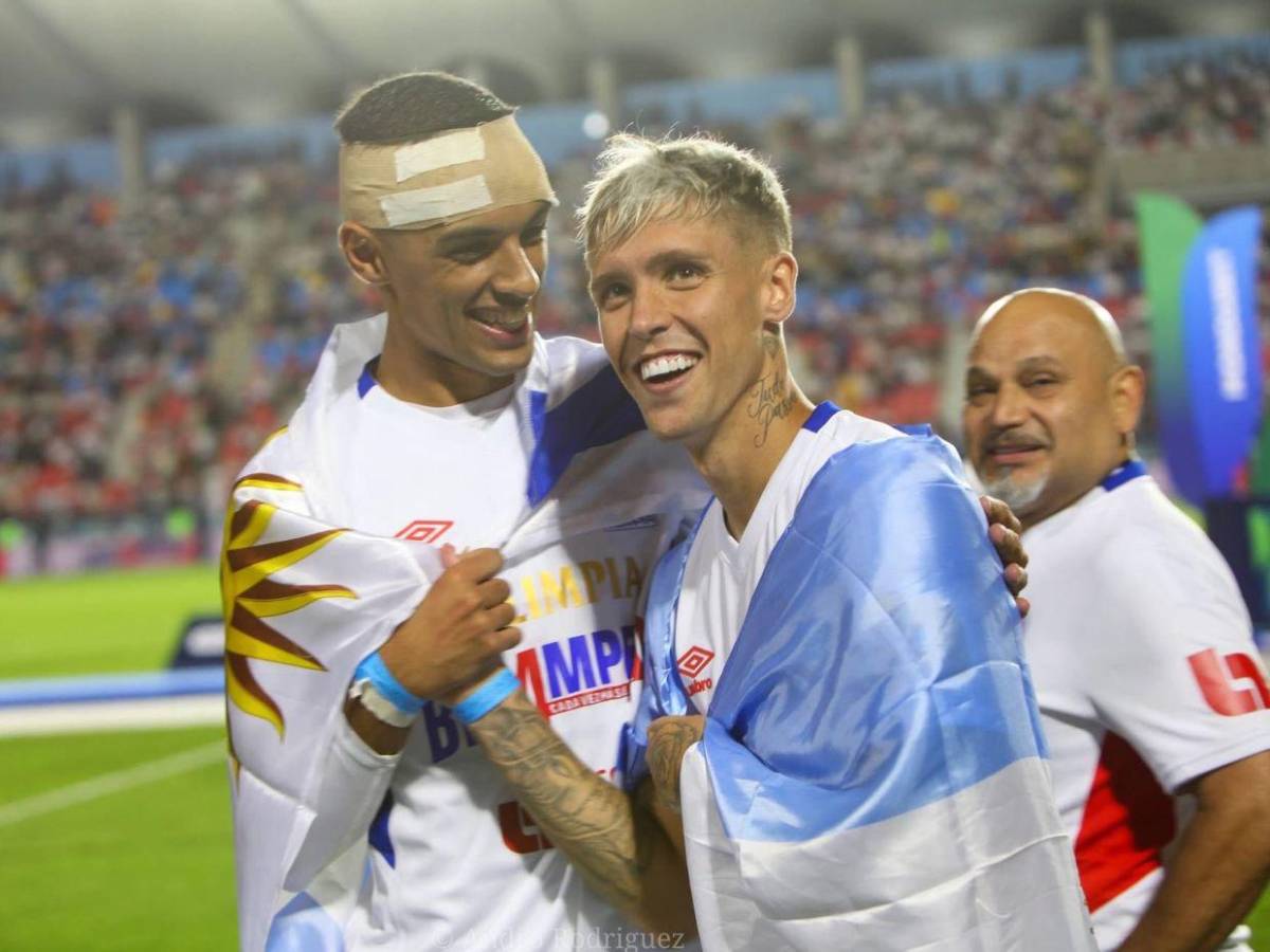 América vale casi 20 veces más que Olimpia: esto cuesta el equipo azteca y el hondureño