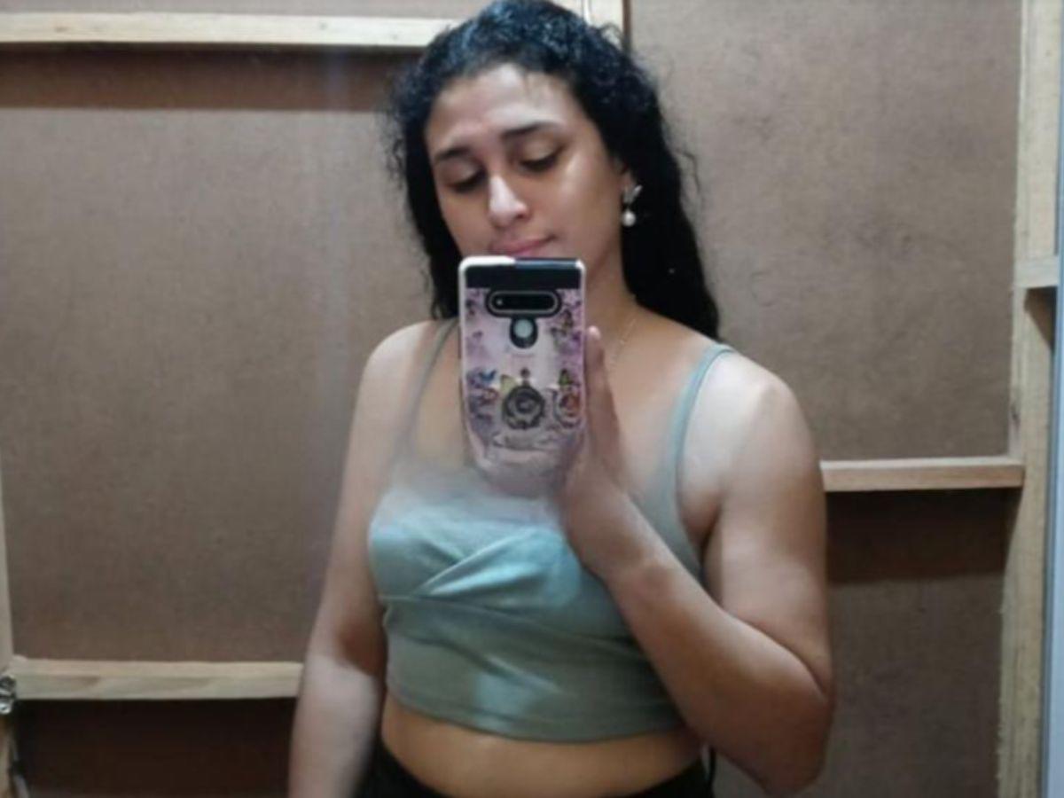 Tiene una hemorragia pulmonar: Nelsy López, la joven que se cayó de la rueda de Chicago en Copán