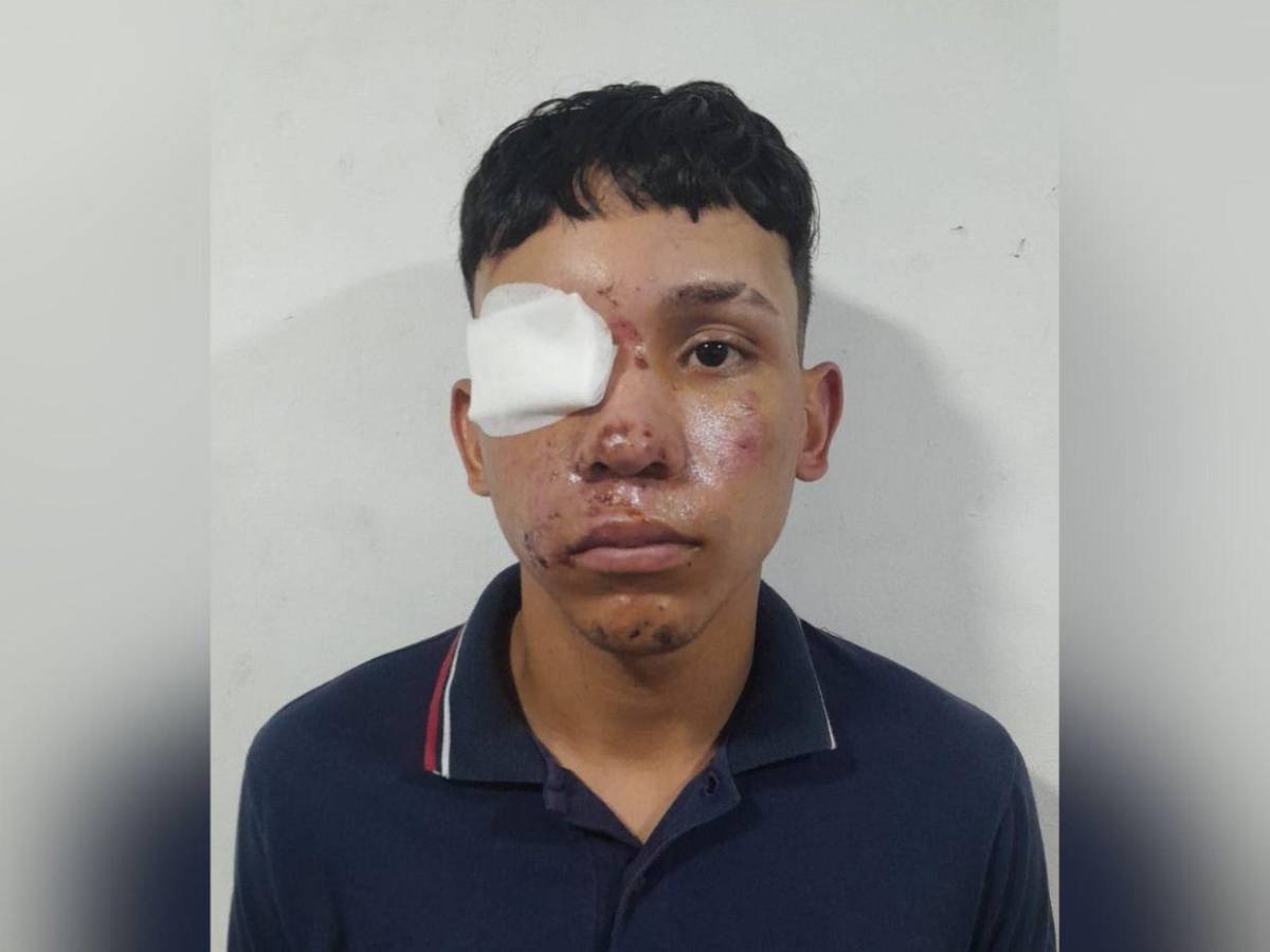 Muerto: así quedó adolescente señalado como autor del asesinato de dos hermanas