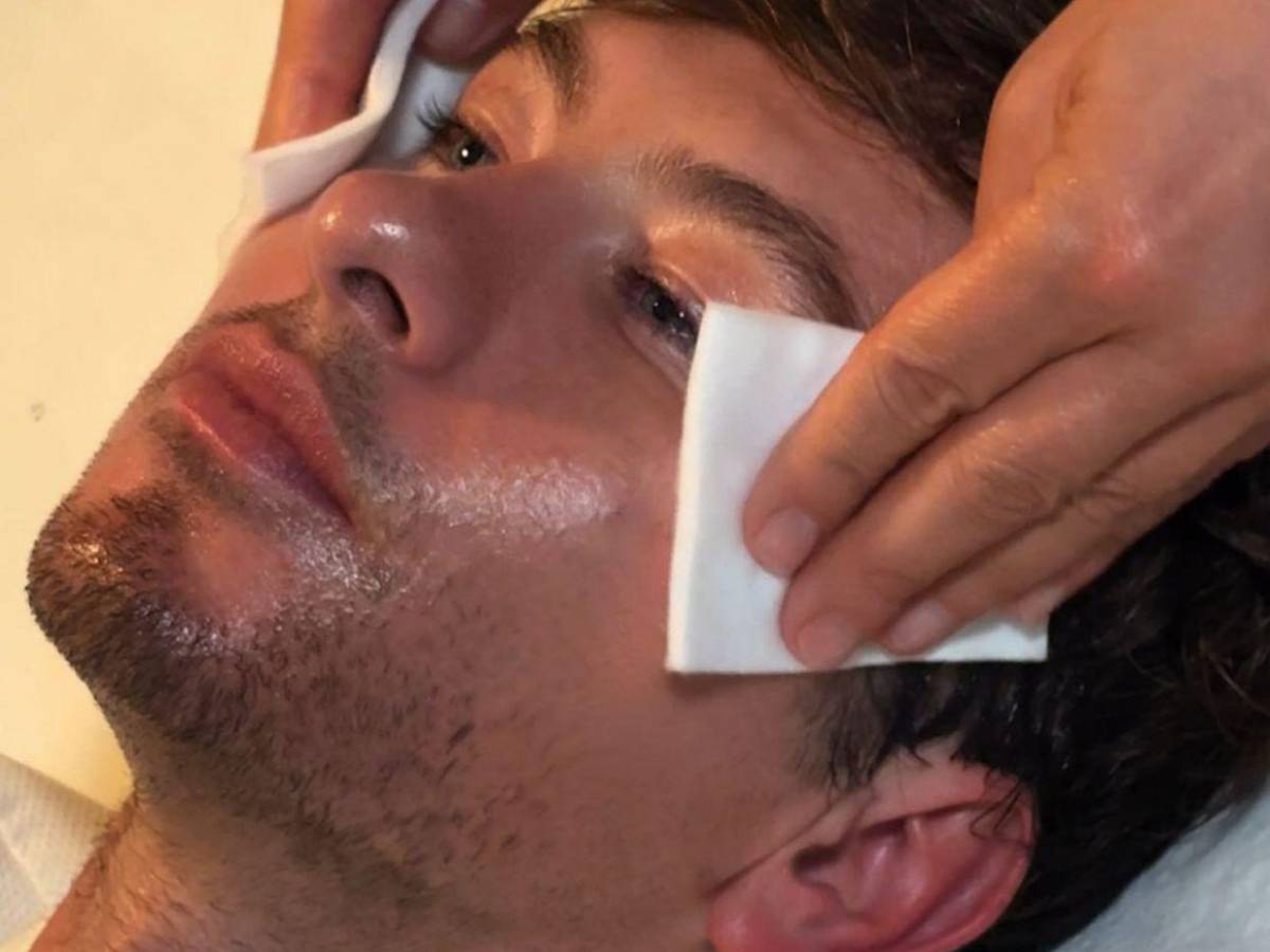 Barry Keoghan afirma que “tiene mejor aspecto” tras probar un tensado facial sin cirugía