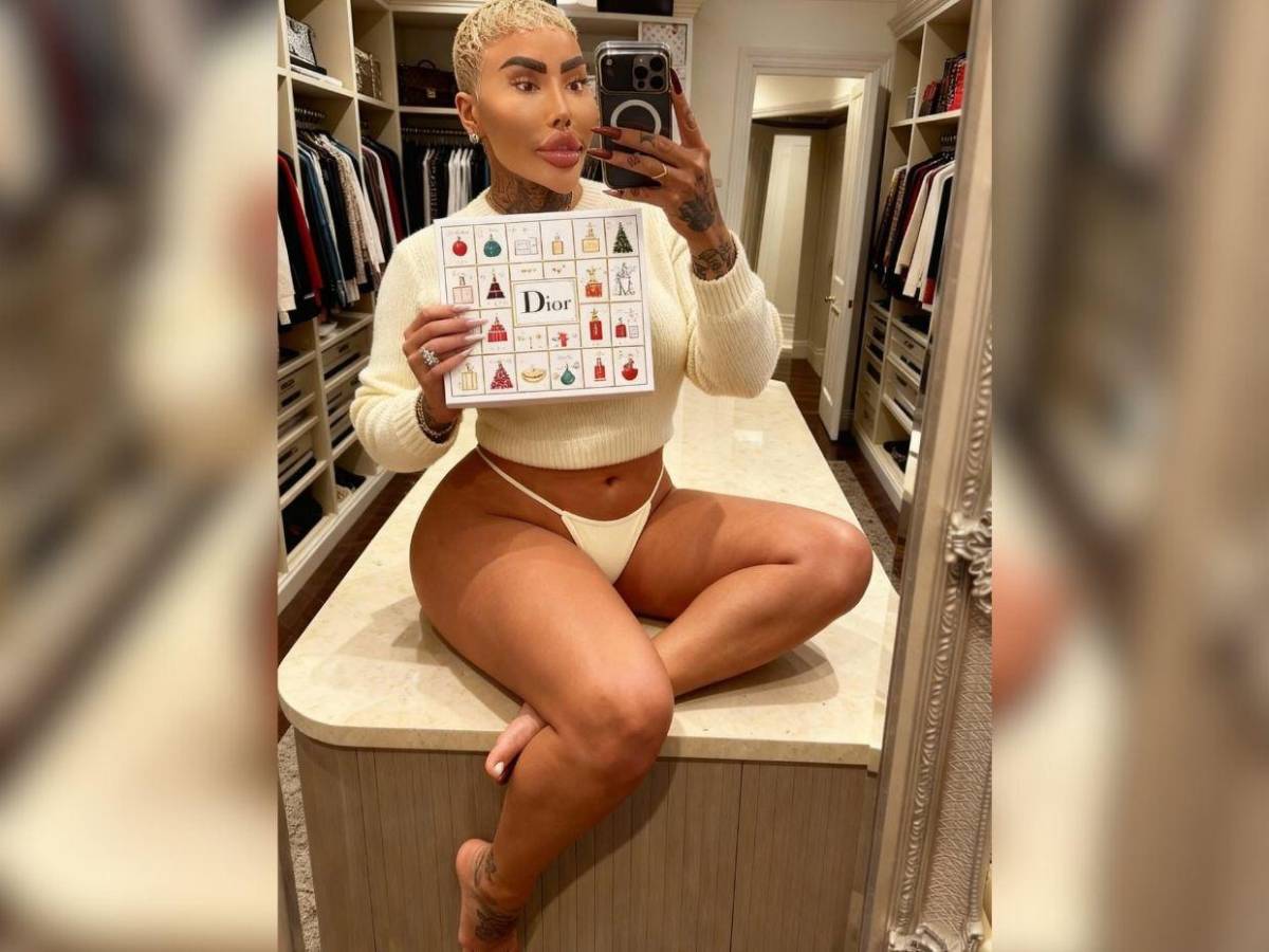 Muere el rey de los labios tras presuntas complicaciones por cirugía estética