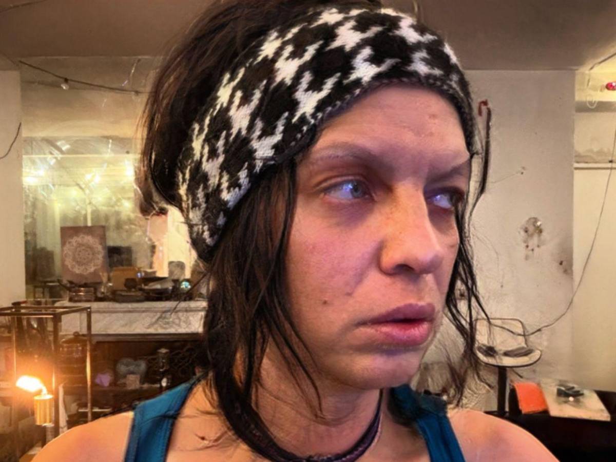 Hija trans de Camilo Sesto ingresa grave a hospital: esto se sabe