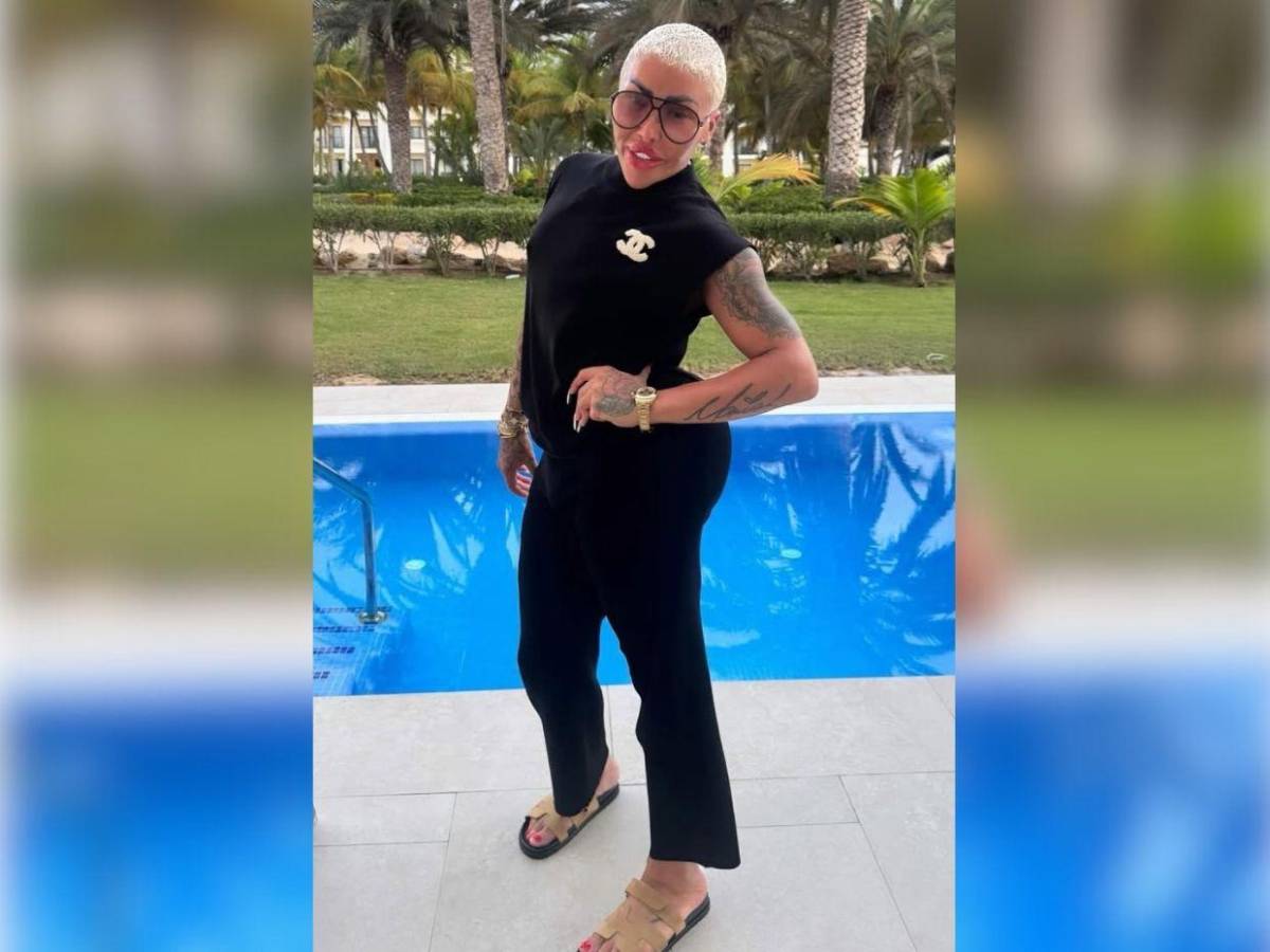 Muere el rey de los labios tras presuntas complicaciones por cirugía estética