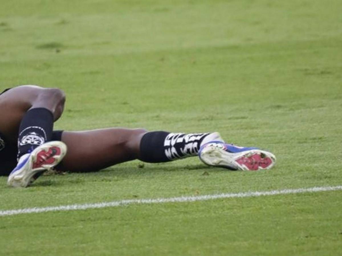 Así fue la espeluznante lesión de tobillo que sufrió Jean Pierre Arroyo