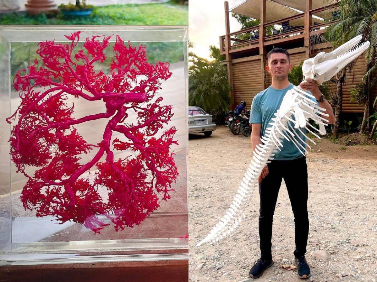 Hondureño transforma placentas en arte y huesos en esculturas sorprendentes