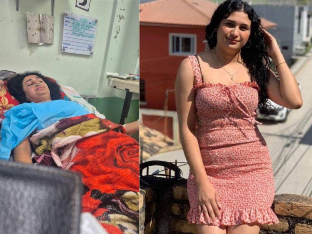 Tiene una hemorragia pulmonar: Nelsy López, la joven que se cayó de la rueda de Chicago en Copán