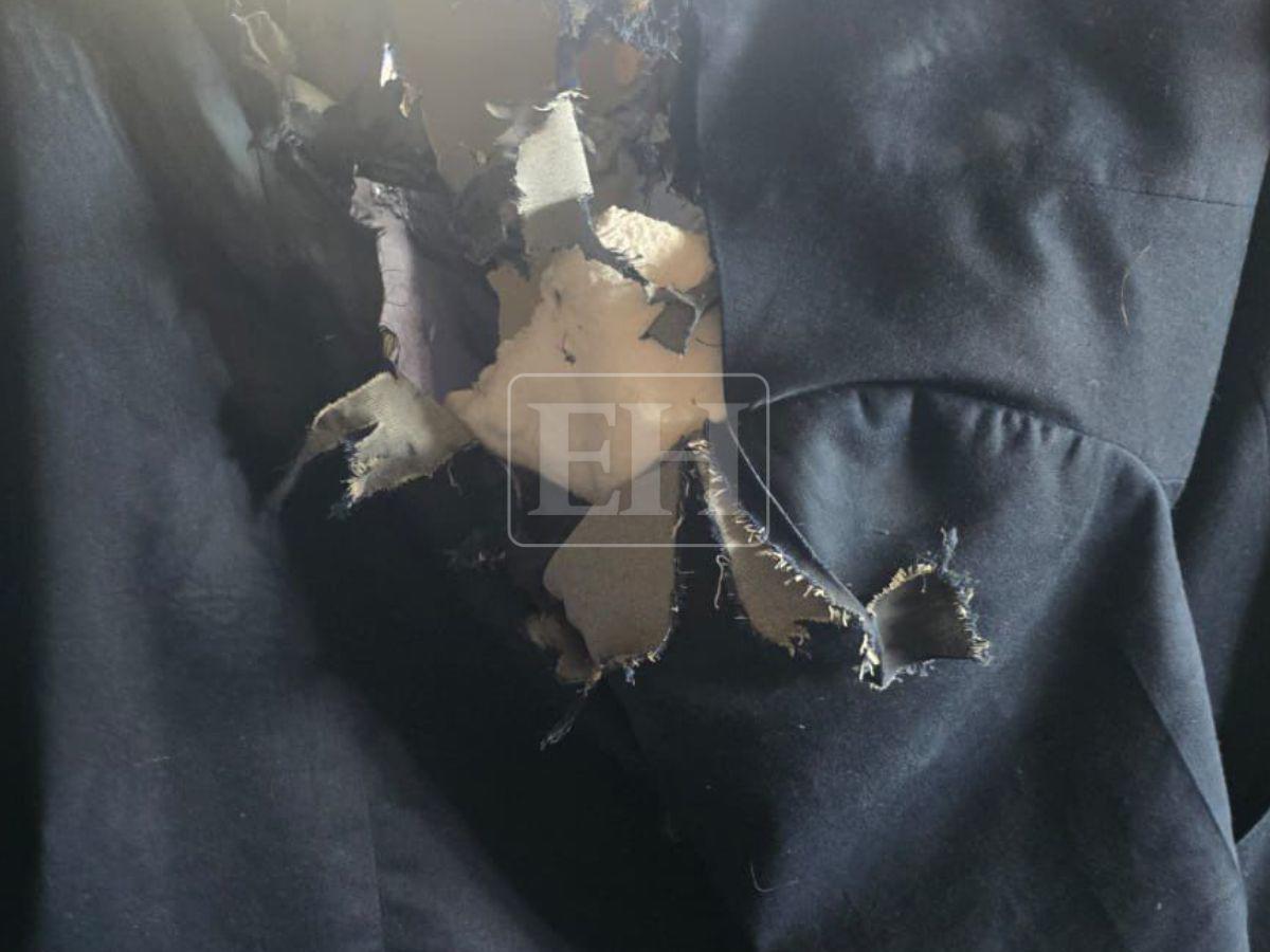 Con heridas en la espalda y cabello quemado: así quedó la diputada Gladis tras ataque con explosivo