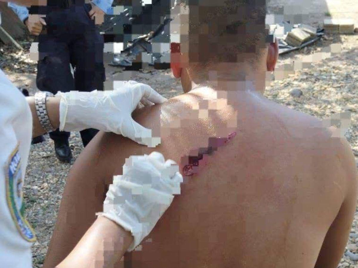 “¡Nos están emboscando, son dos carros!”: Revelan momentos de terror que vivieron policías en Colón