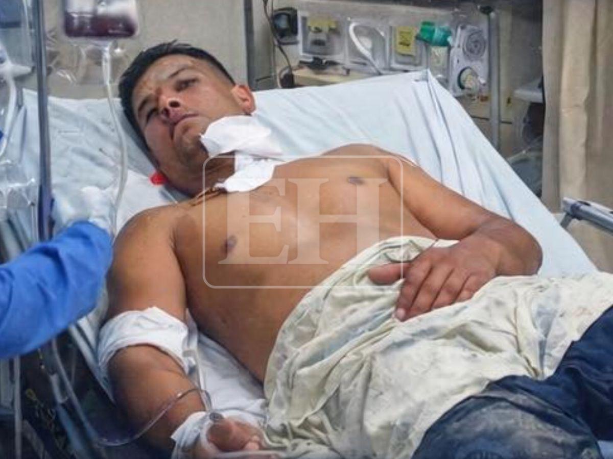 Heridas en el cuello y antebrazo: estado de salud de los policías heridos en La Masica