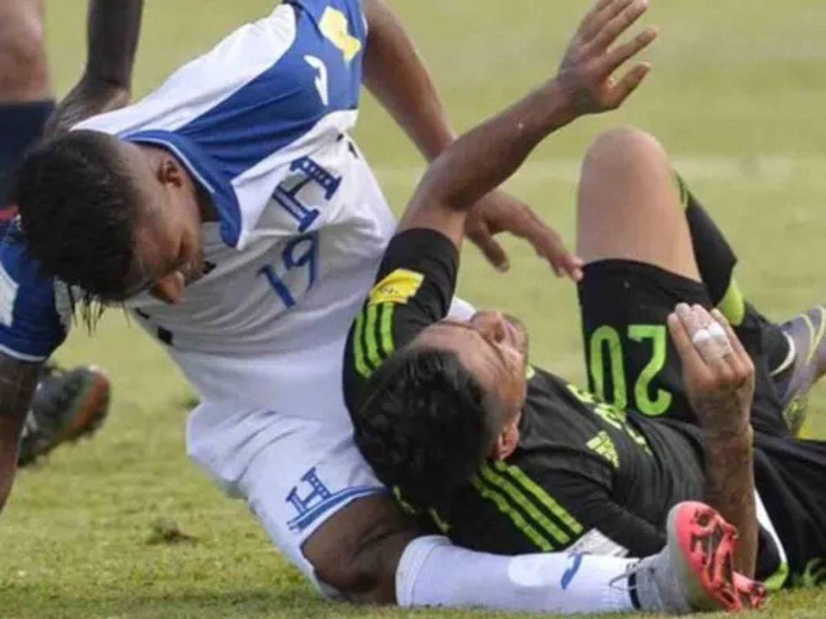 Las lesiones más escalofriantes que han ocurrido en el fútbol hondureño