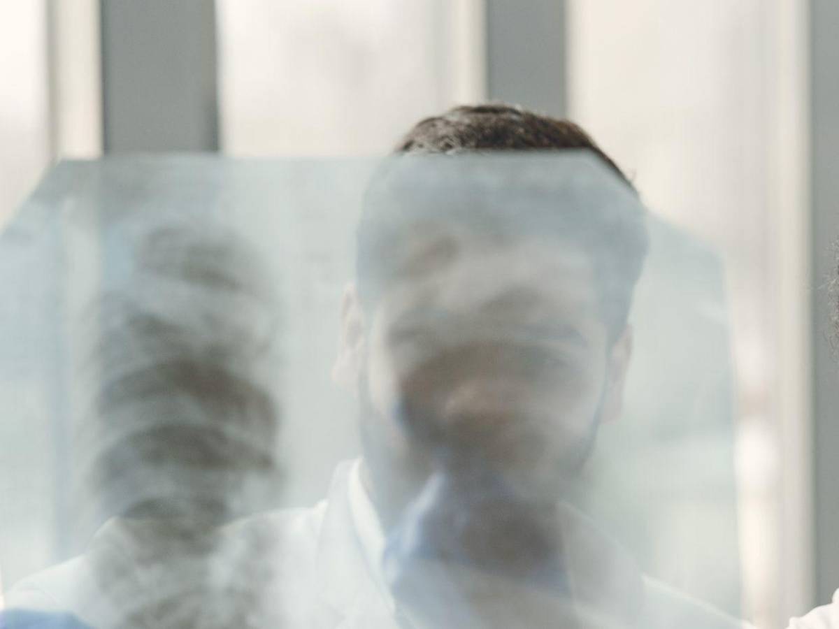 Monoterapia: ¿En qué consiste el tratamiento que enfrenta Carlos Zelaya por cáncer?