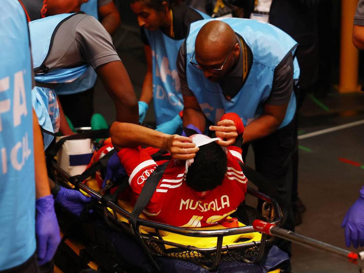 Bayern Múnich confirma la lesión de Jamal Musiala: Esta es la preocupación del club