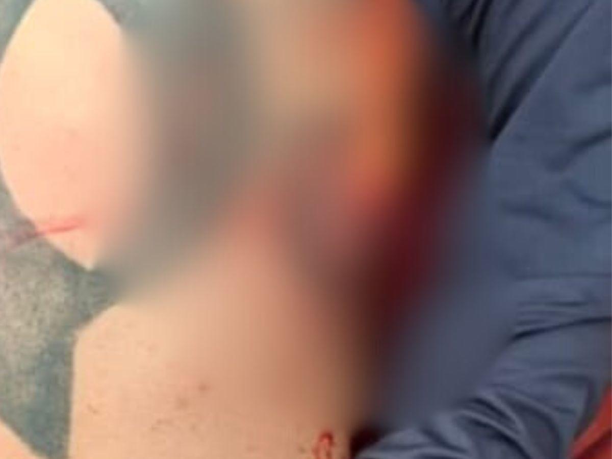 Tenía el número 18 tatuado en el pecho: así fue la balacera en Ciudad España que dejó un muerto