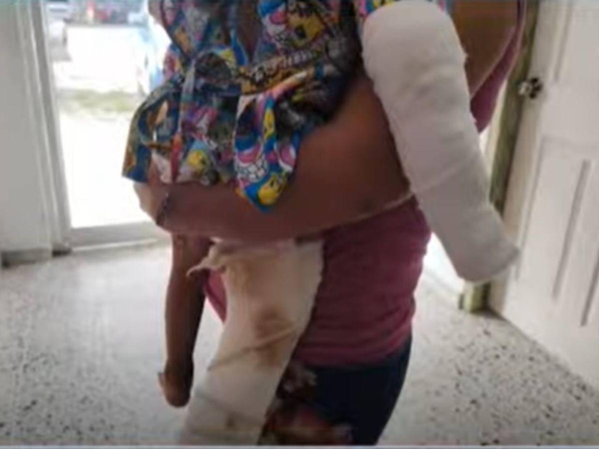 Él me lo quemó, por celos, denuncia madre de menor agredido por su pareja