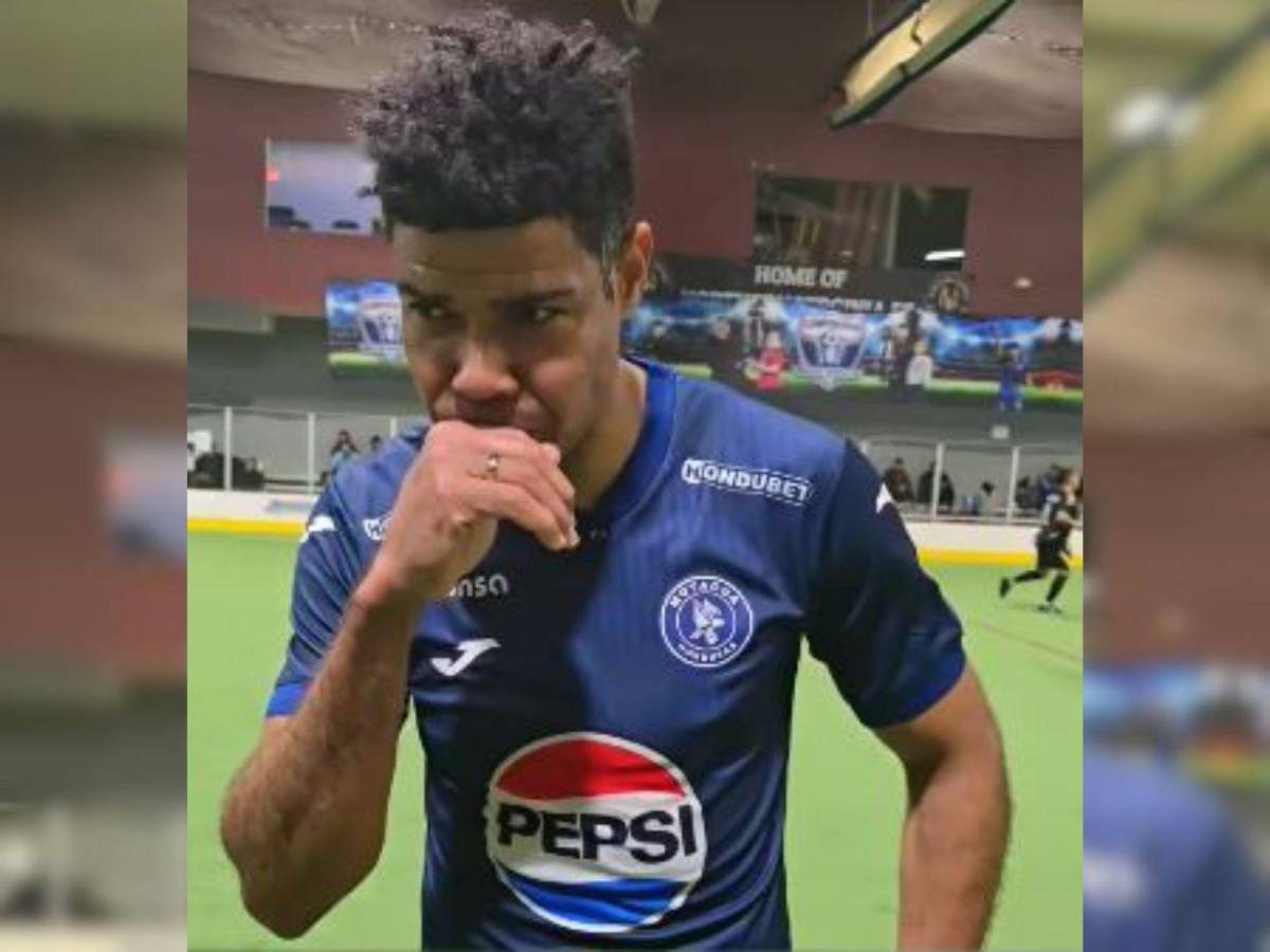 Así es la nueva vida de Shannon Welcome en EE UU: ¿Qué le pasó en su boca?