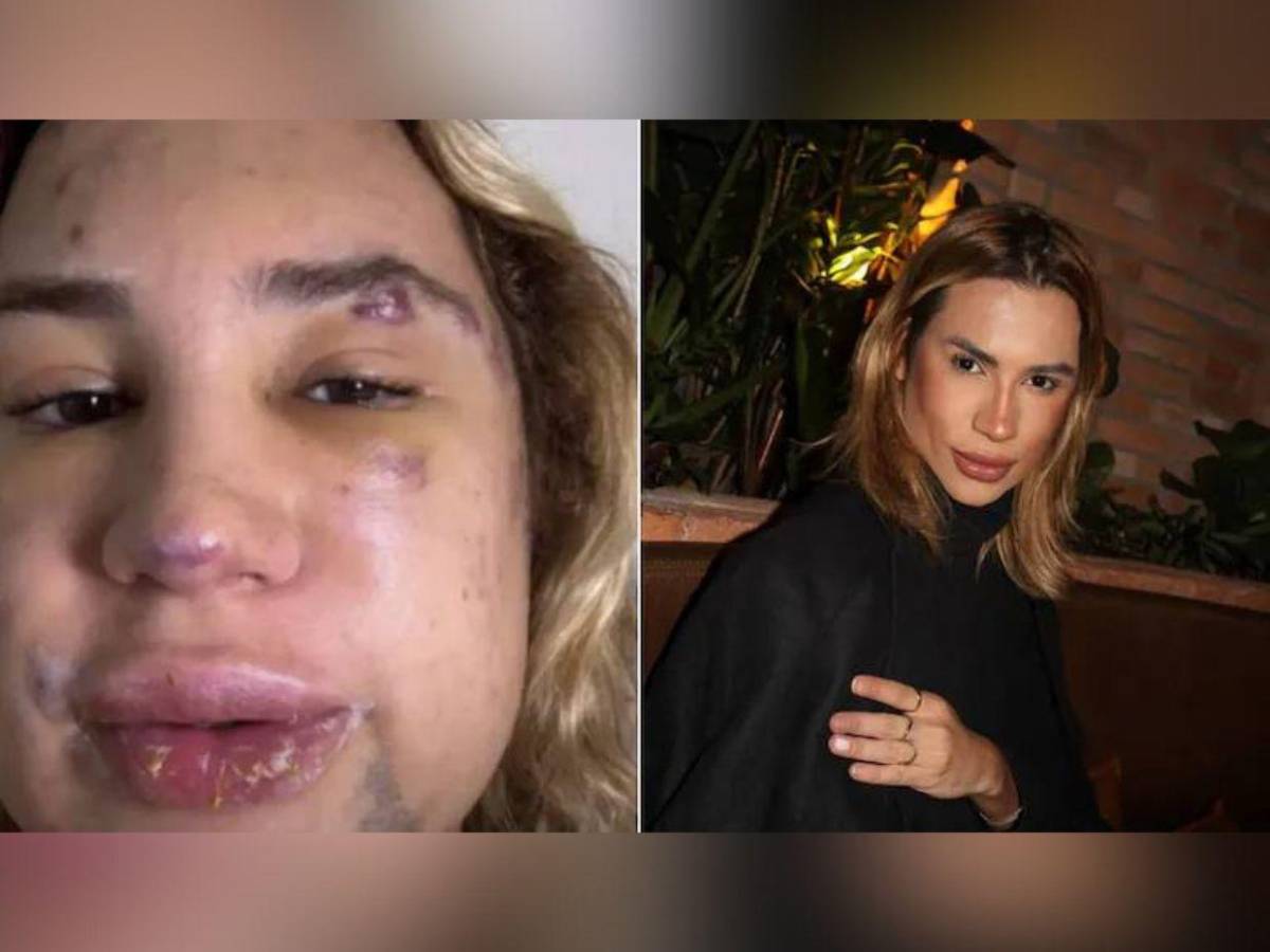 Adair Dutra, estilista brasileño que murió tras cirugía estética foxy eyes