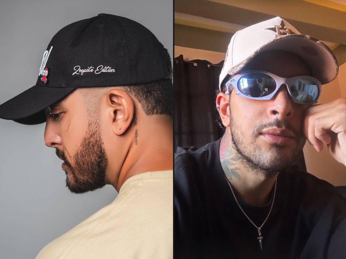 El antes y después de Fancony tras cirugía ortognática: “Soy más feliz que nunca”