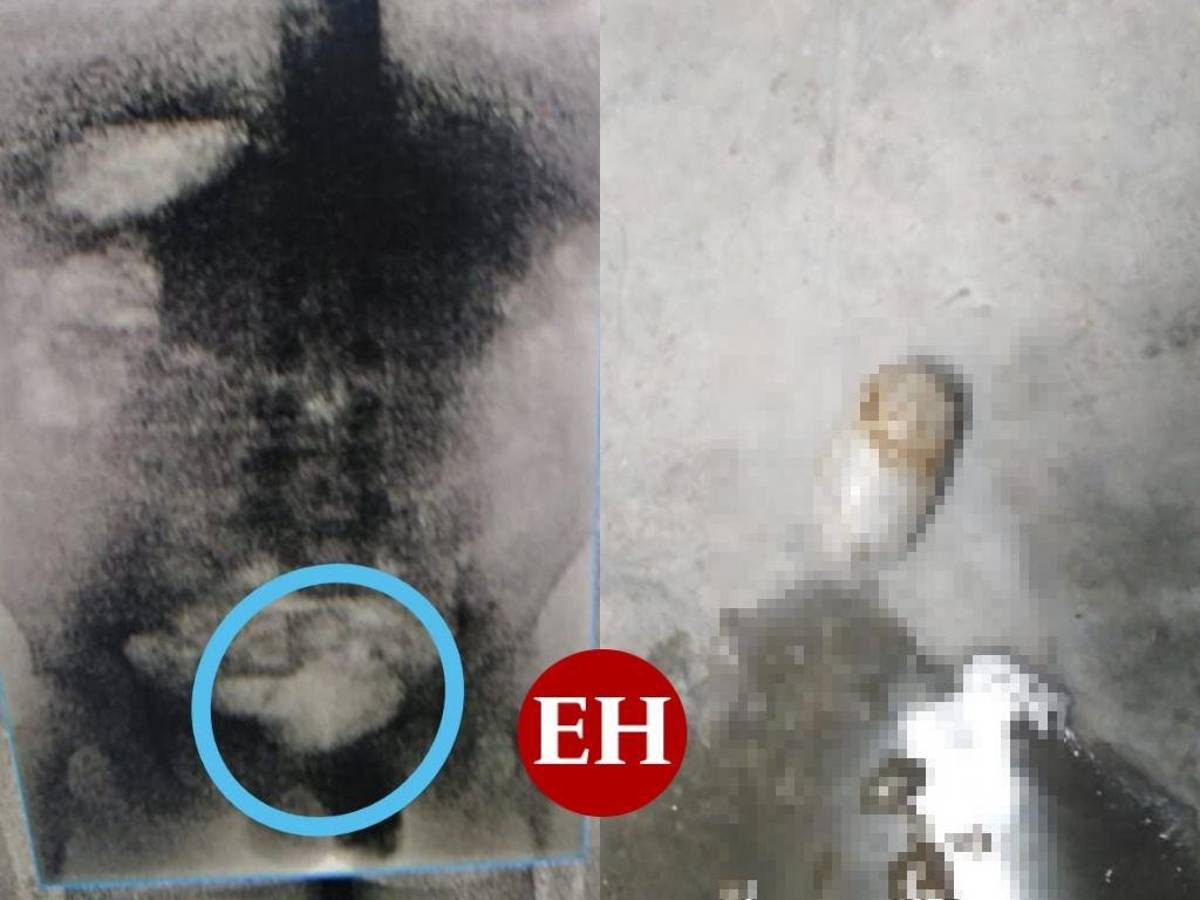 Privado de libertad llevaba droga dentro de su cuerpo en Morocelí