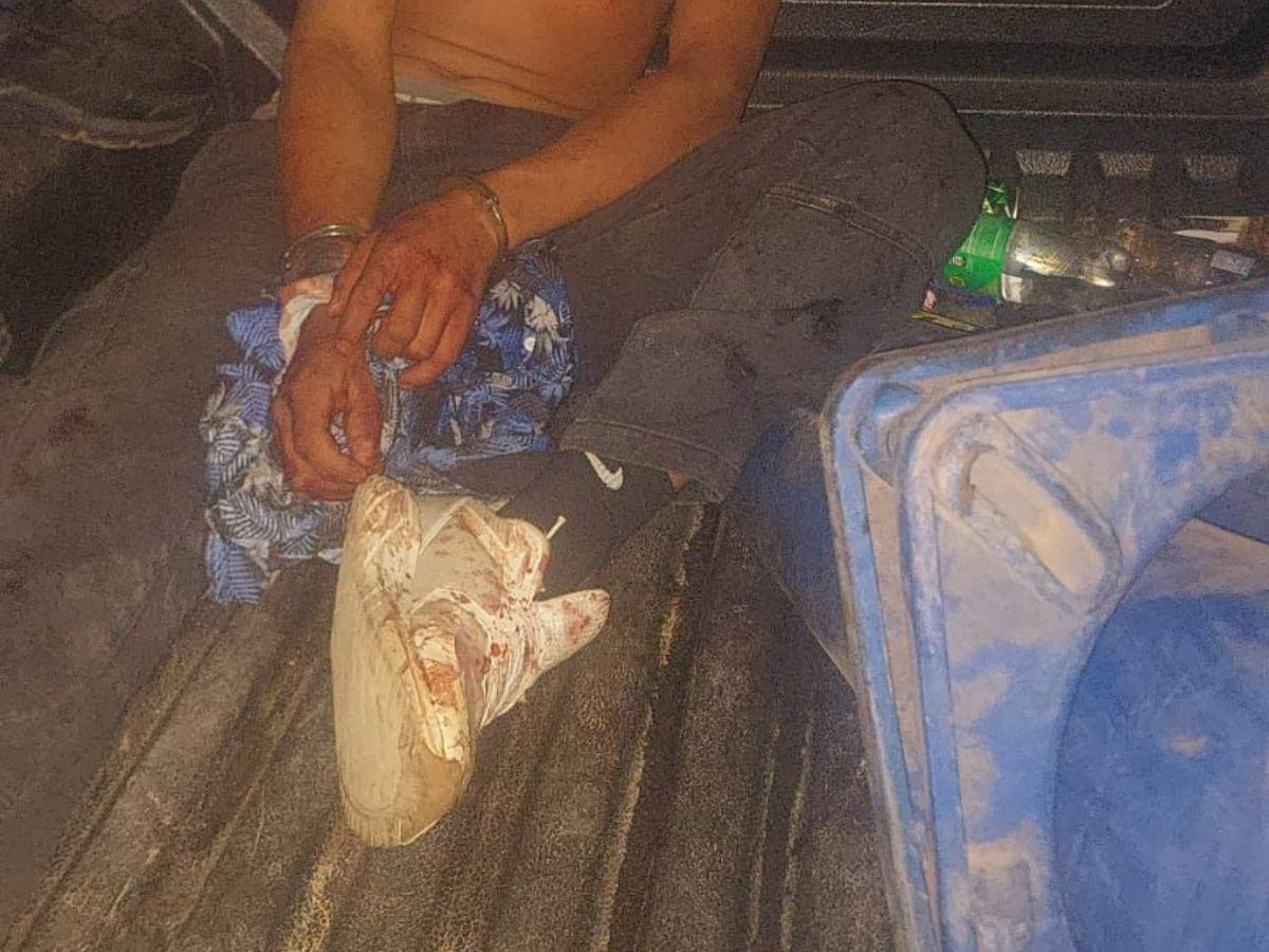 Lo golpeó varias veces en la cabeza: así mataron a pedradas a un hombre en Olancho