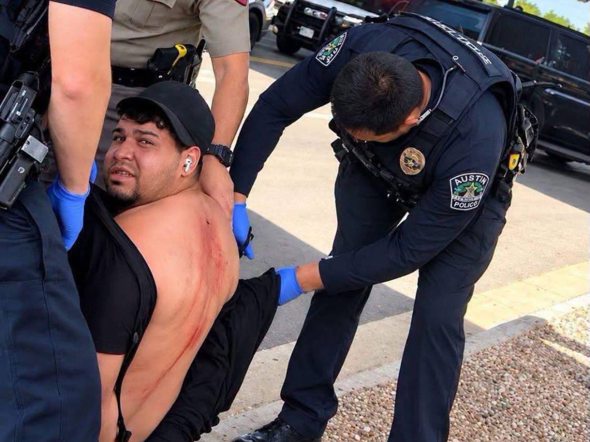 Le dispararon en la espalda: Wilber Garcés, migrante herido por un agente de ICE, necesita cirugía