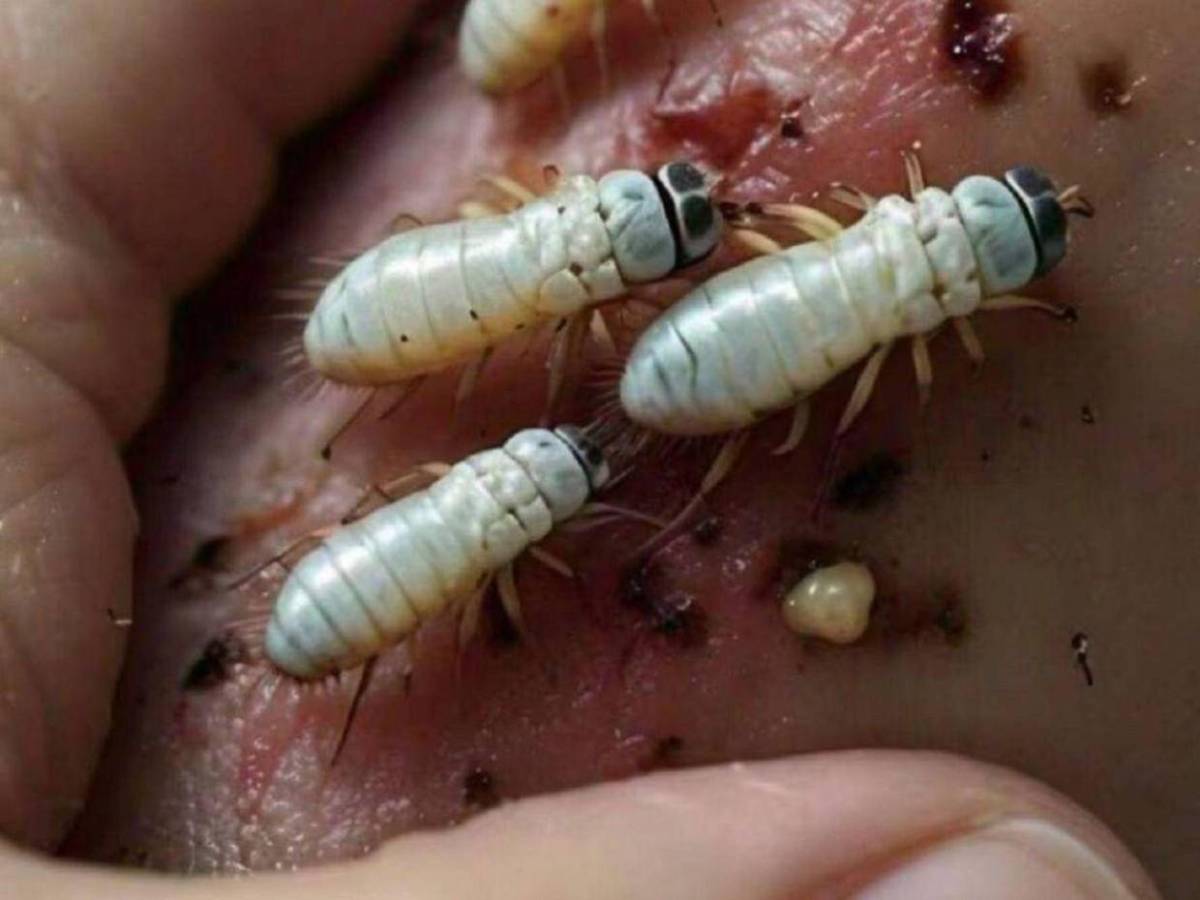 Devorador de hombres, así invade y prolifera en heridas humanas el gusano barrenador